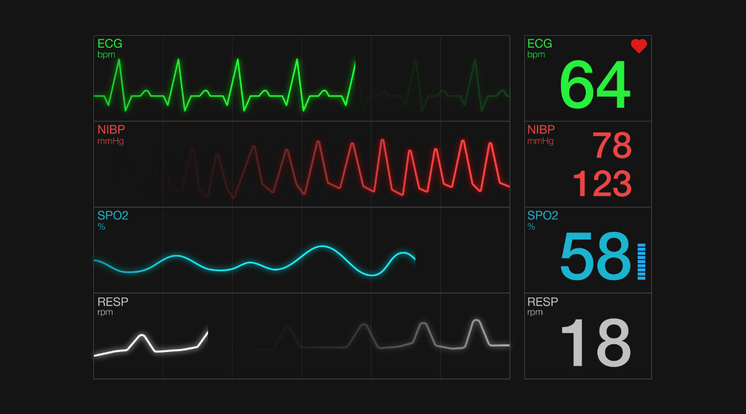 EKG u kliničkoj praksi 3