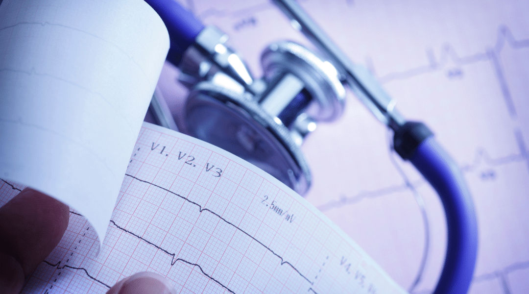 EKG u kliničkoj praksi 2
